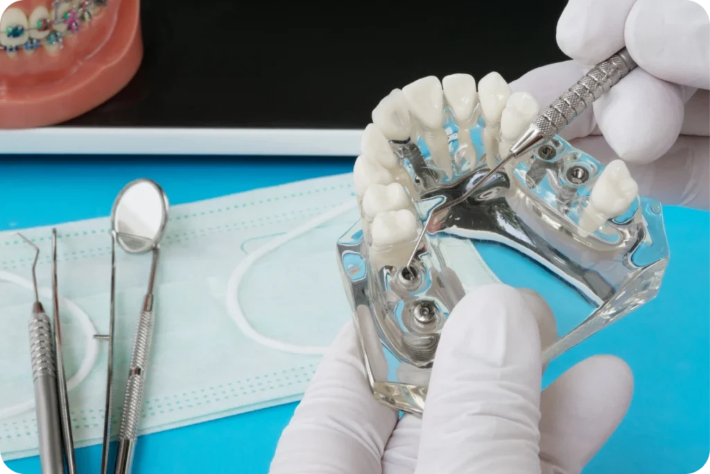 chirurgie dentaire guidee dentiste bourgoin jaillieu chirurgie dentaire guidee dentiste bourgoin jaillieu Chirurgie guidée Dentistes Bourgoin-Jallieu | Cabinet dentaire Y2