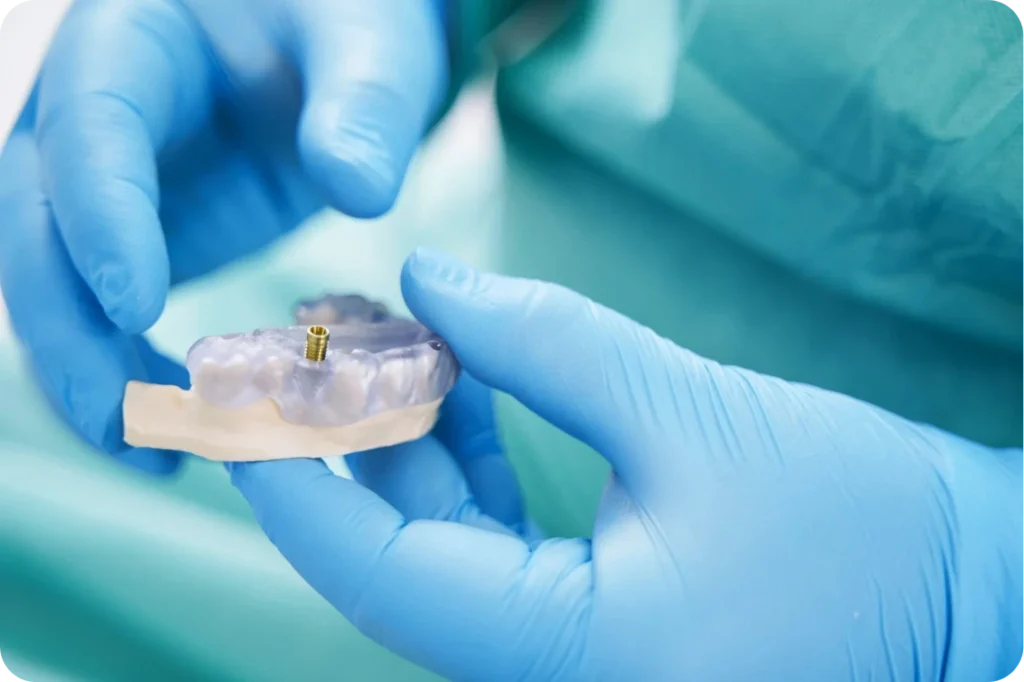 chirurgie guidee implantologie dentiste bourgoin jaillieu chirurgie guidee implantologie dentiste bourgoin jaillieu Chirurgie guidée Dentistes Bourgoin-Jallieu | Cabinet dentaire Y2
