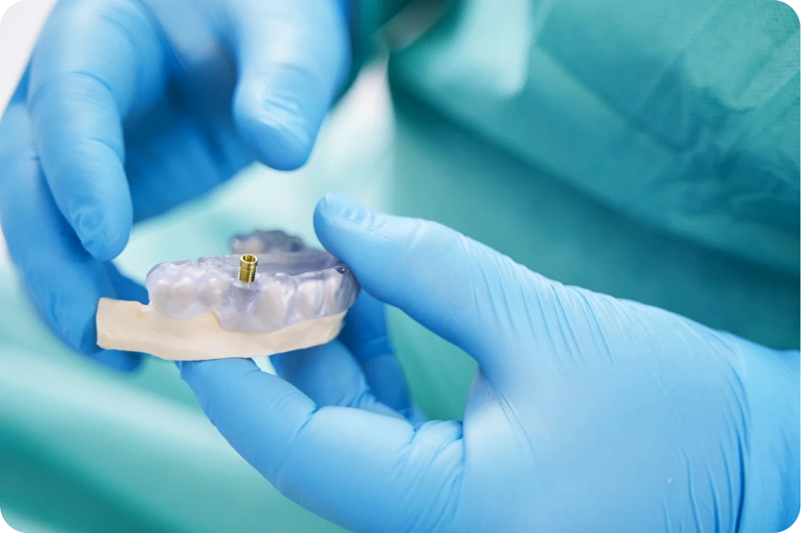 chirurgie guidee implantologie dentiste bourgoin jaillieu Chirurgie guidée Dentistes Bourgoin-Jallieu | Cabinet dentaire Y2