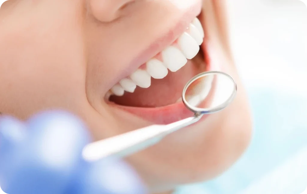 consultation dentiste traitement esthetique dentistes bourgoin jaillieu Couronnes céramiques Dentistes Bourgoin-Jallieu | Cabinet dentaire Y2