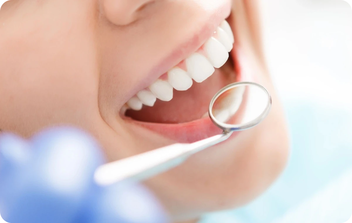 consultation dentiste traitement esthetique dentistes bourgoin jaillieu Traitement des tâches Dentistes Bourgoin-Jallieu | Cabinet dentaire Y2