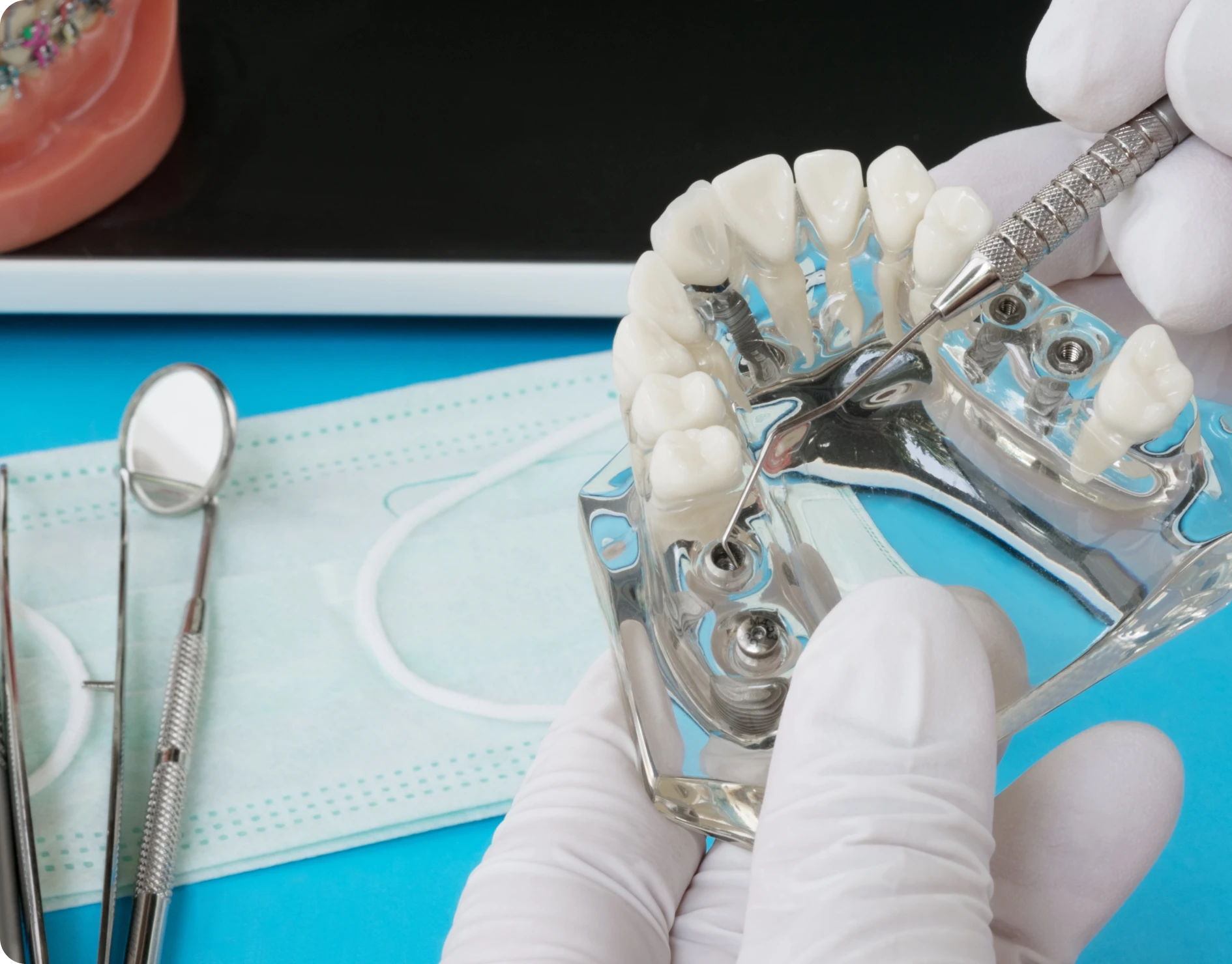 dr yee dentiste bourgoin jaillieu Accueil Dentistes Bourgoin-Jallieu | Cabinet dentaire Y2