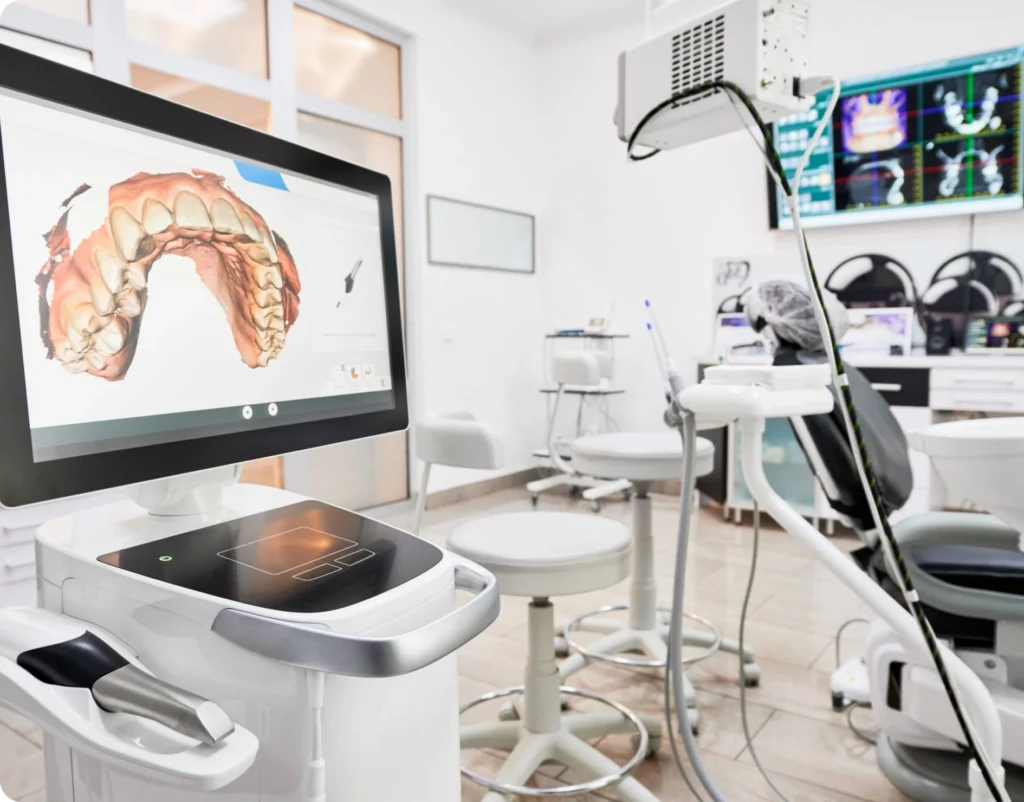 empreinte optique dentiste bourgoin jaillieu empreinte optique dentiste bourgoin jaillieu Inlay, Onlay, Overlay Dentistes Bourgoin-Jallieu | Cabinet dentaire Y2