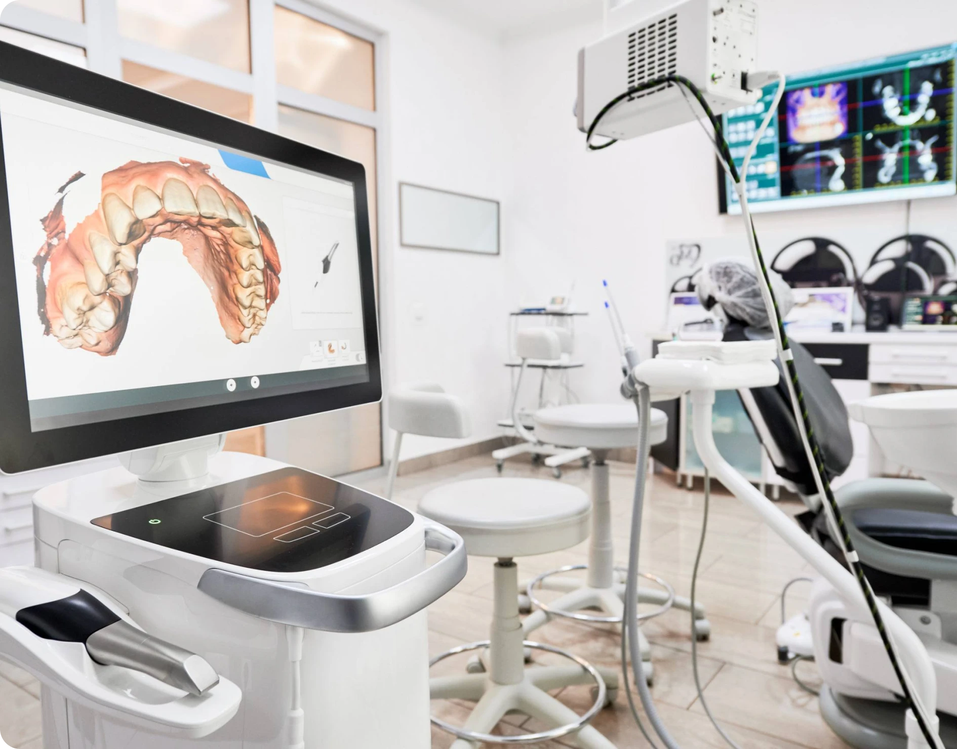 empreinte optique dentiste bourgoin jaillieu Accueil Dentistes Bourgoin-Jallieu | Cabinet dentaire Y2