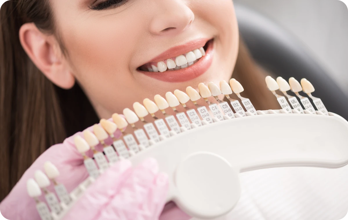 facette dentaire bourgoin jaillieu Facettes dentaires Dentistes Bourgoin-Jallieu | Cabinet dentaire Y2