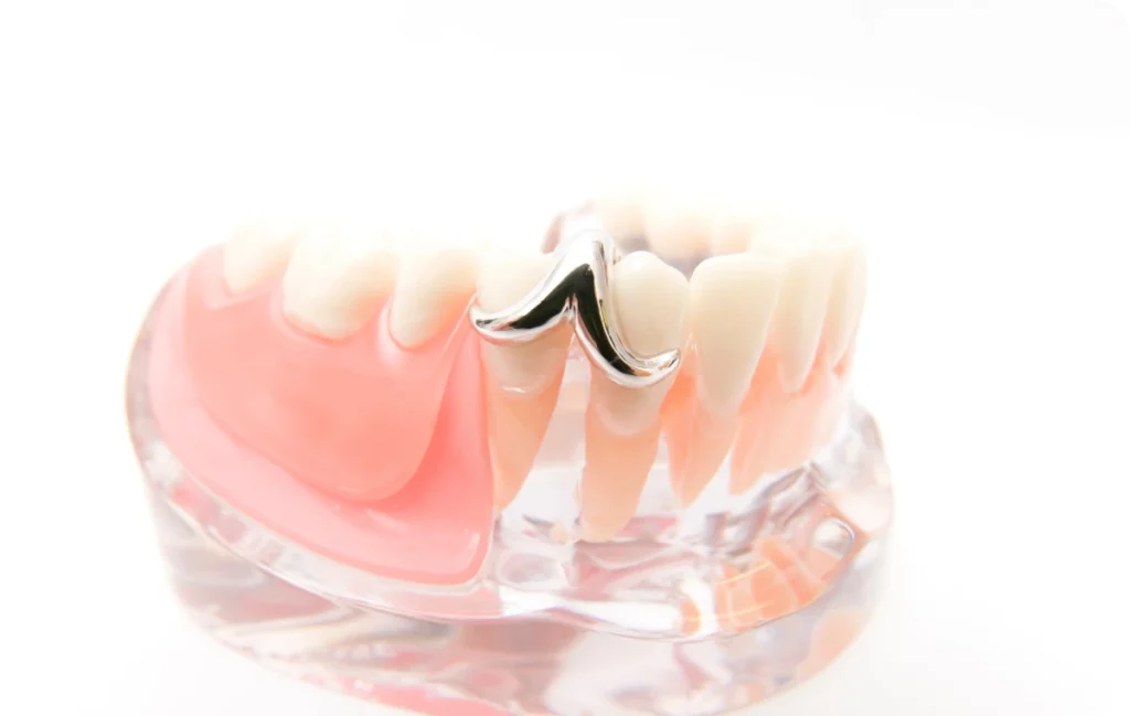 protheses amovibles dentistes bourgoin jaillieu protheses amovibles dentistes bourgoin jaillieu Prothèses amovibles Dentistes Bourgoin-Jallieu | Cabinet dentaire Y2